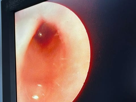 Videoendoskopie im Gehörgang einer Katze: Ansammlung von entzündlichem Material